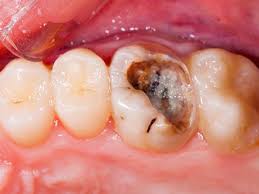 مشکلات دندان