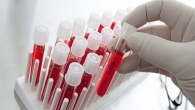 استفاده از سلول‌های خون قاعدگی برای درمان ناباروری