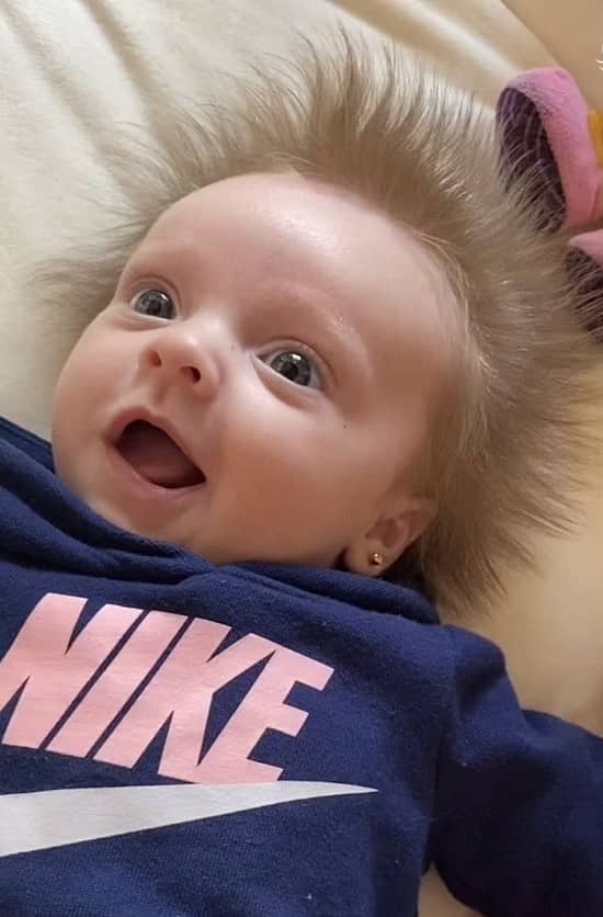 نوزاد عجیبی که همه را شگفت زده کرده است+ تصاویر