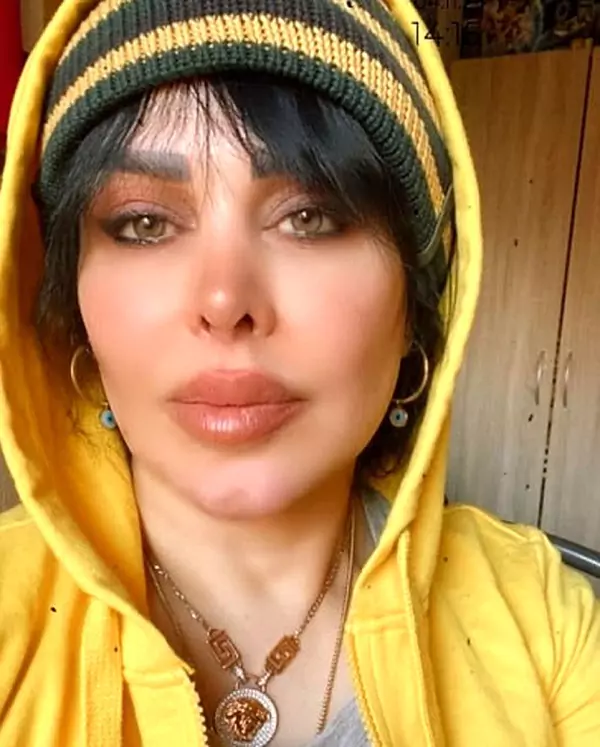 لاغری عجیب فلور نظری باعث نگرانی شد+ عکس