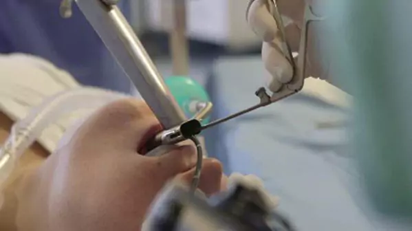 اهدای ۶ دستگاه لارنگوسکوپ به اتاق عمل بیمارستان کودکان مفید