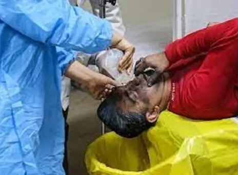 آخرین جزییات حوادث چهارشنبه‌سوری امسال در کل کشور  /قطع عضو ۱۶۲ نفر/ ۱۹ فوتی ۲۵۶۲ مصدوم