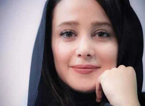 تغییر چهره الناز حبیبی از ۱۹ سالگی تا اکنون
