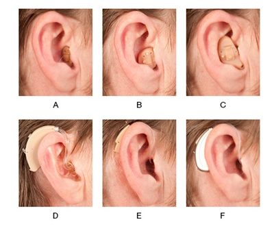 کمبود سمعک واقعی نیست، رقابت کمک به بیماران می‌کند