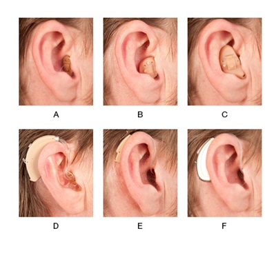 کمبود سمعک واقعی نیست، رقابت کمک به بیماران می‌کند